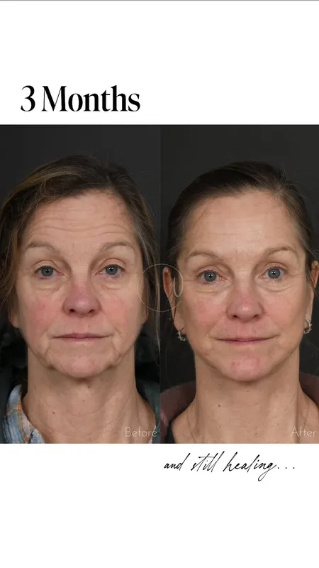 Before and after — Dr. Matthew Urban