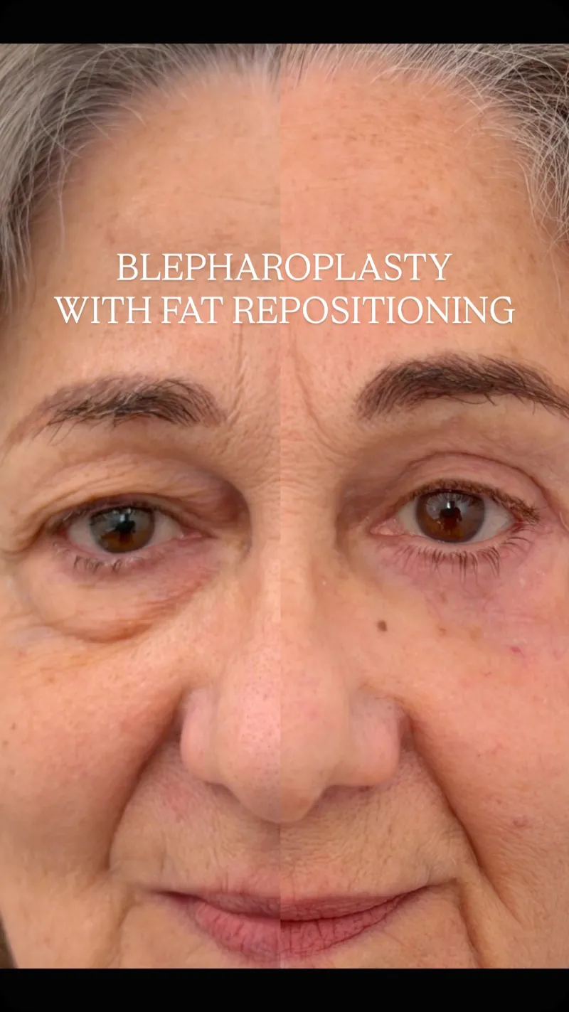 Before and after: Dr. Mattia Siliprandi
