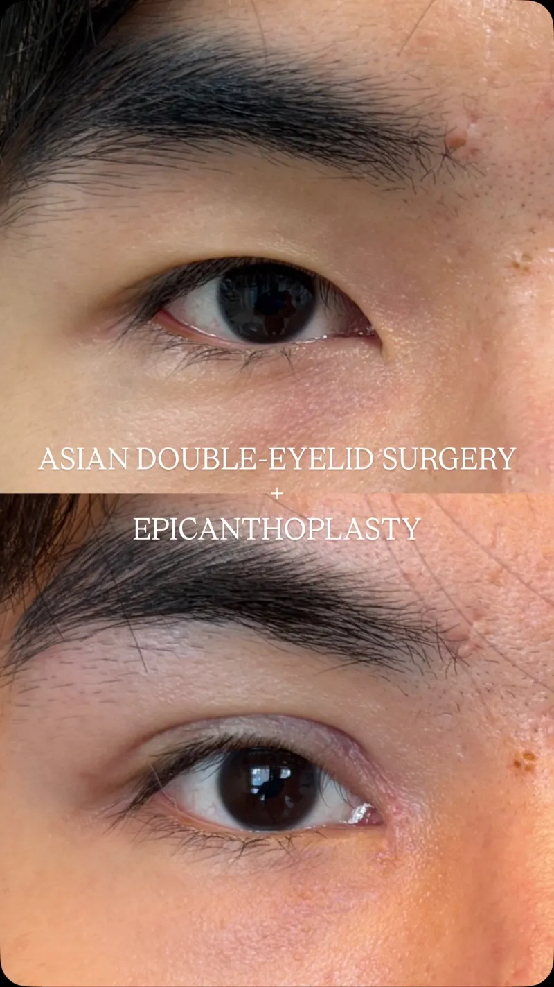 Before and after: Dr. Mattia Siliprandi
