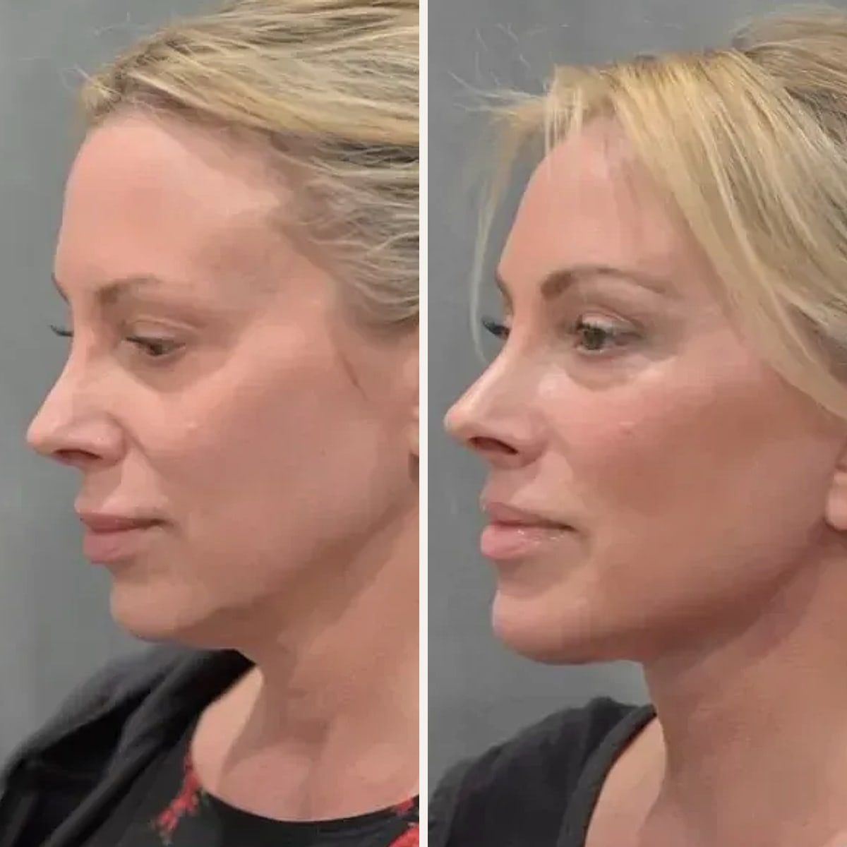 Before and after: Dr. Mehdi Sina