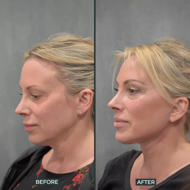 Before and after — Dr. Mehdi Sina