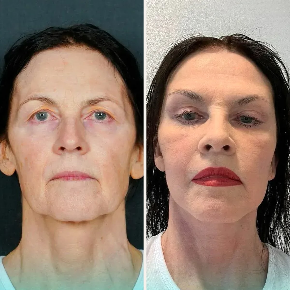 Before and after: Dr. Mehmet Özdemir