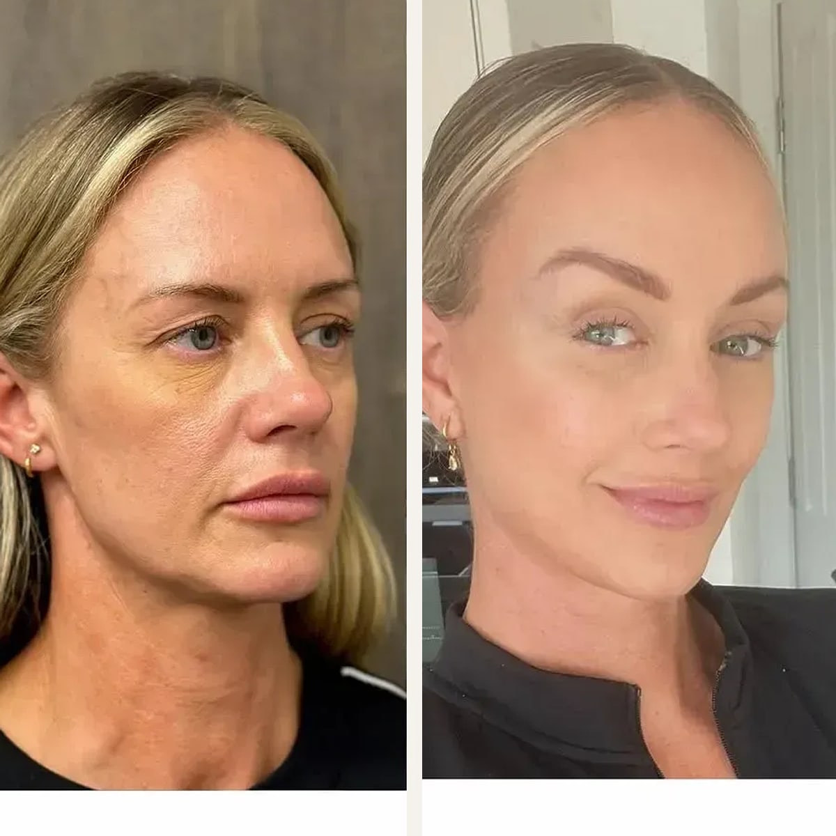 Before and after: Dr. Mehti Salviz