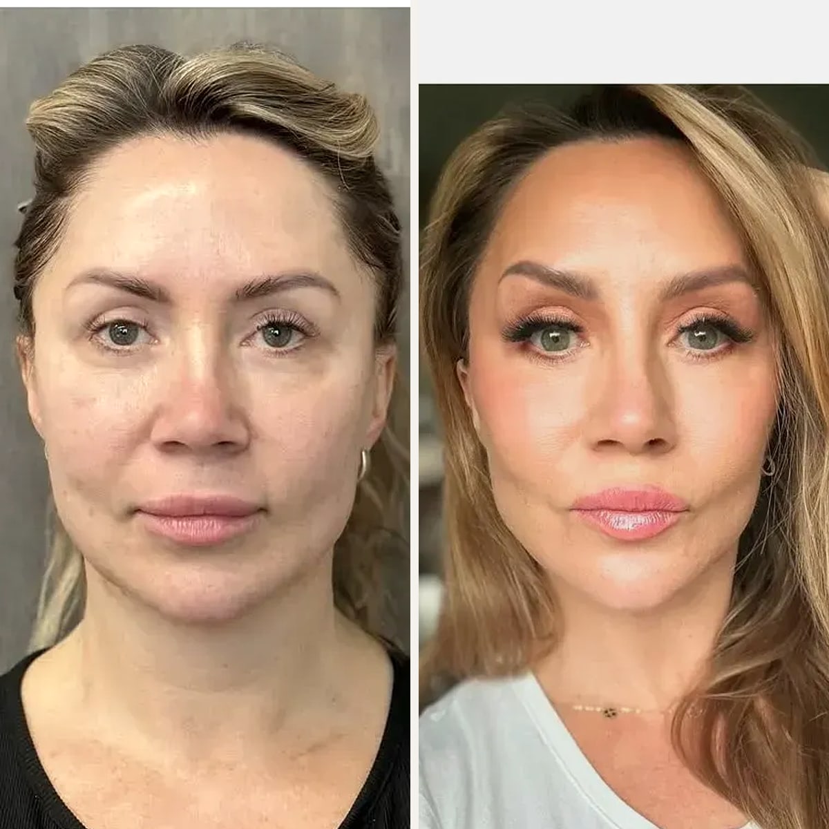 Before and after: Dr. Mehti Salviz