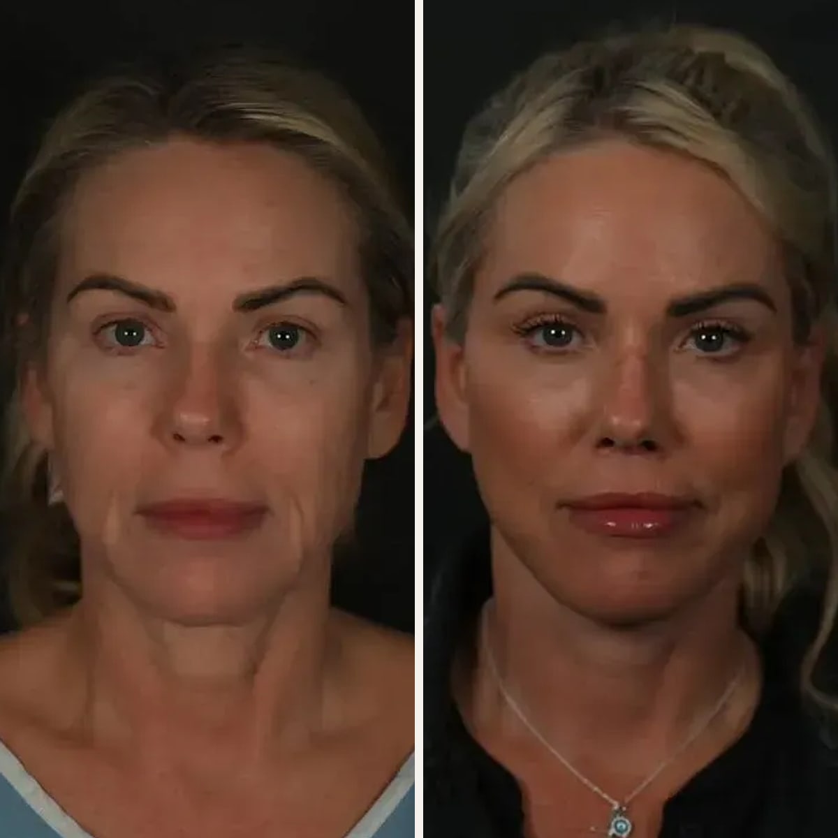 Before and after: Dr. Michael Roskies