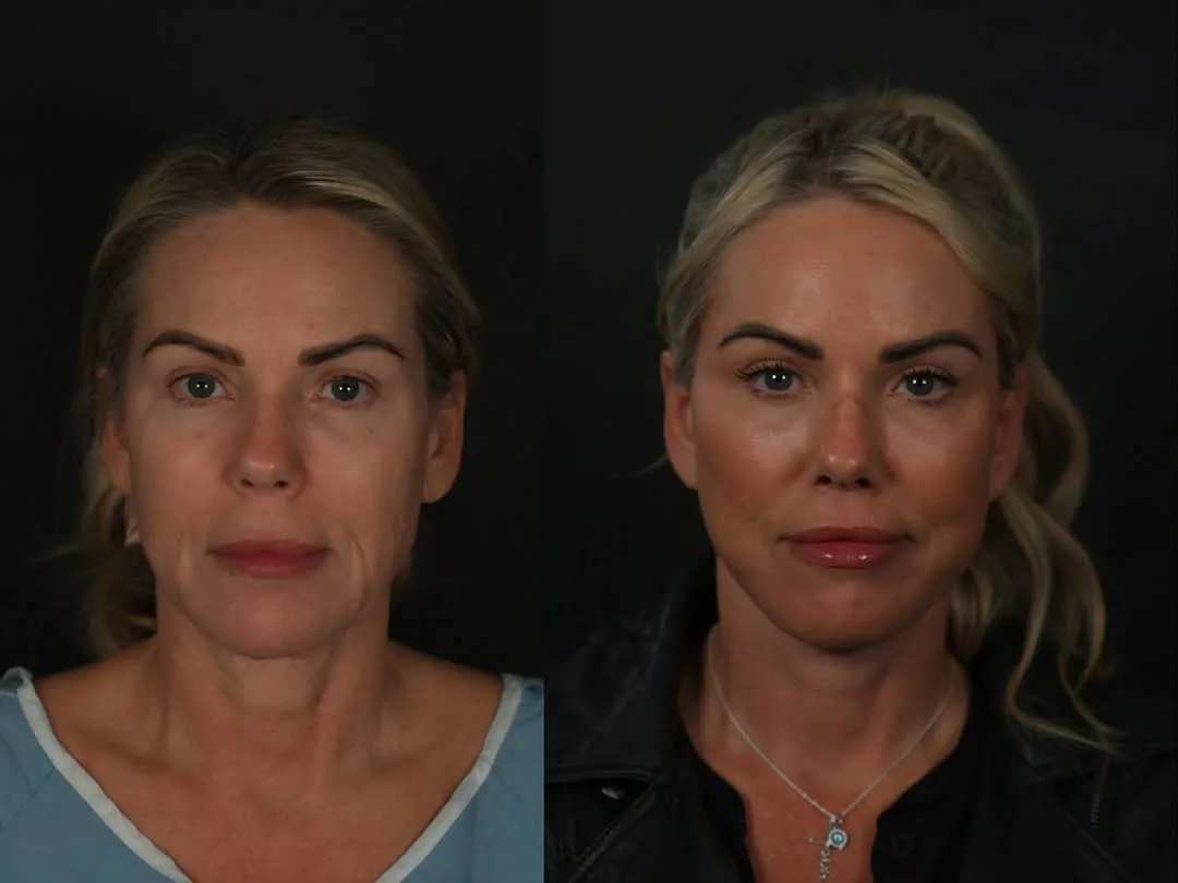 Before and after — Dr. Michael Roskies