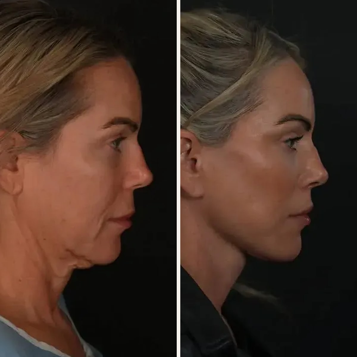 Before and after: Dr. Michael Roskies