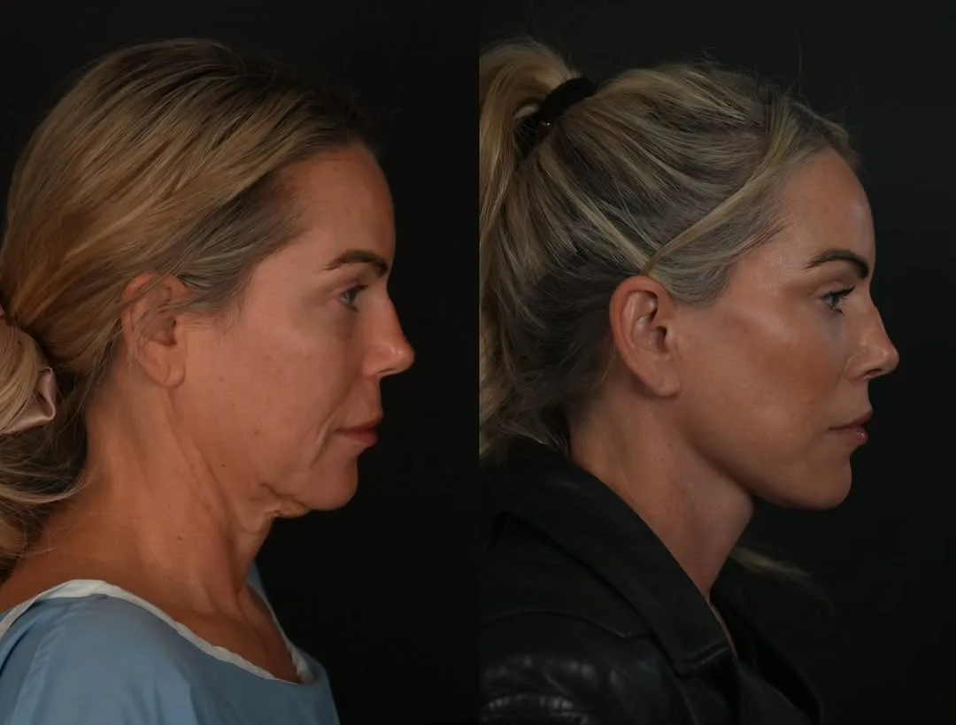 Before and after — Dr. Michael Roskies