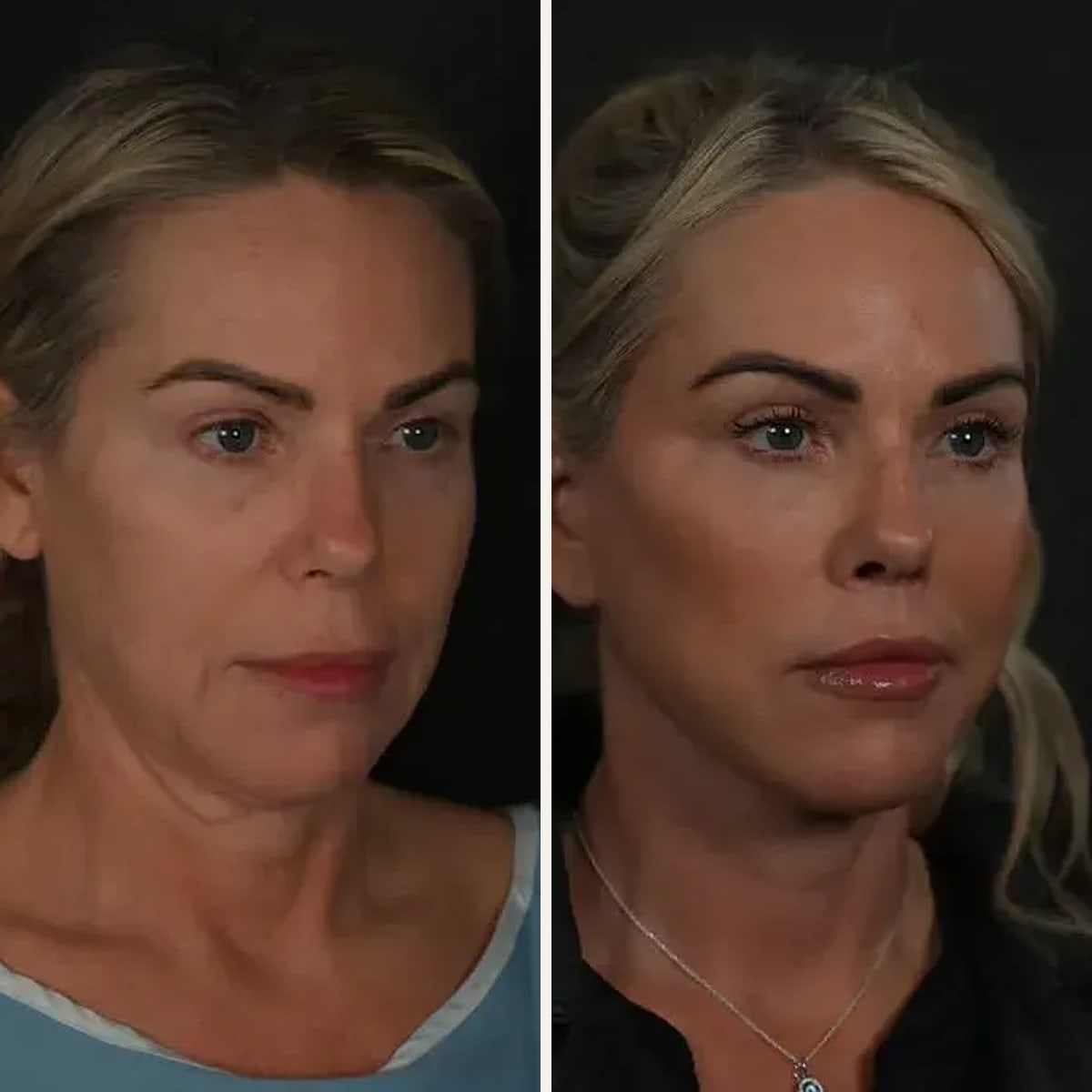 Before and after: Dr. Michael Roskies