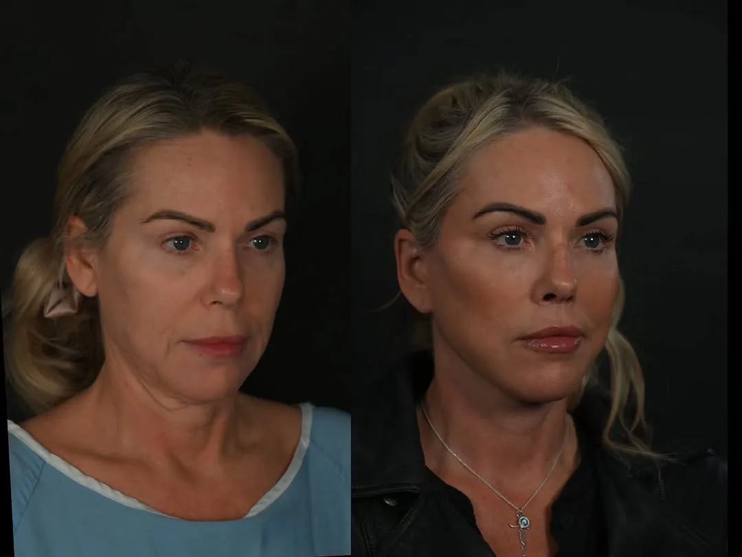 Before and after — Dr. Michael Roskies