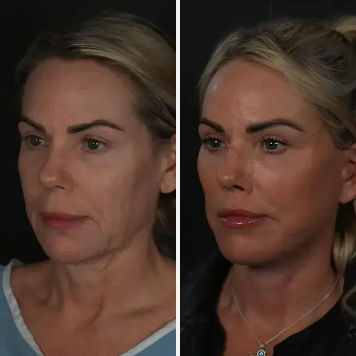 Before and after: Dr. Michael Roskies