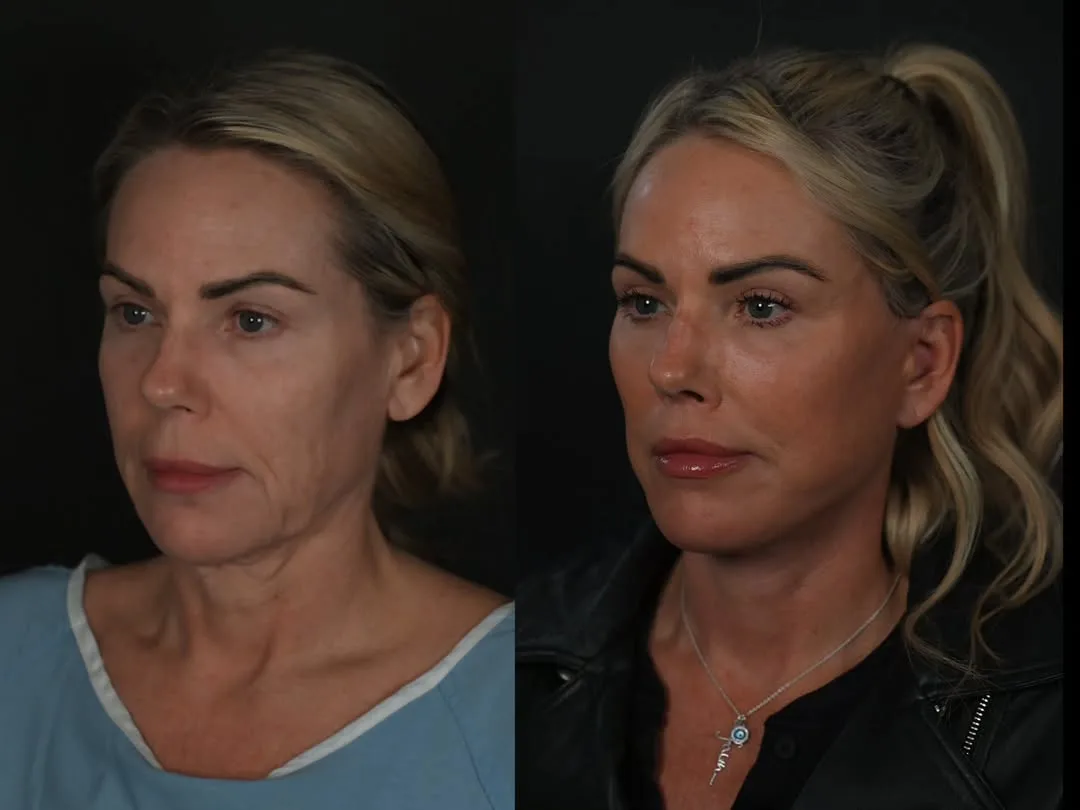 Before and after — Dr. Michael Roskies