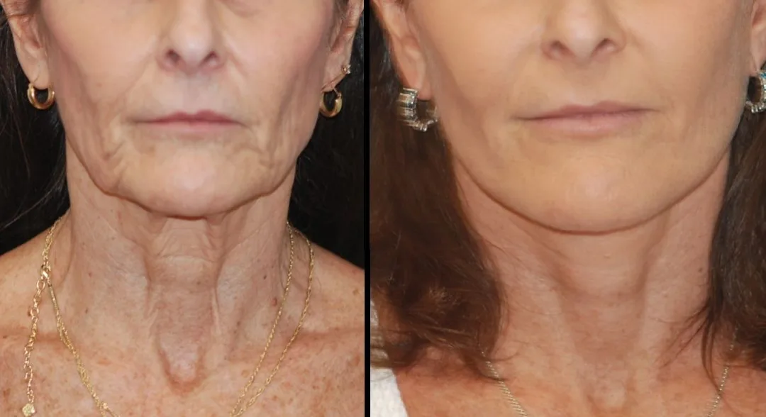 Before and after — Dr. Michael S. Godin