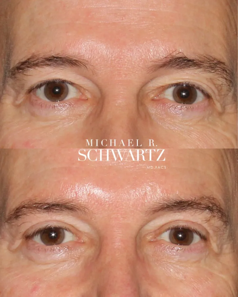 Before and after: Dr. Michael Schwartz