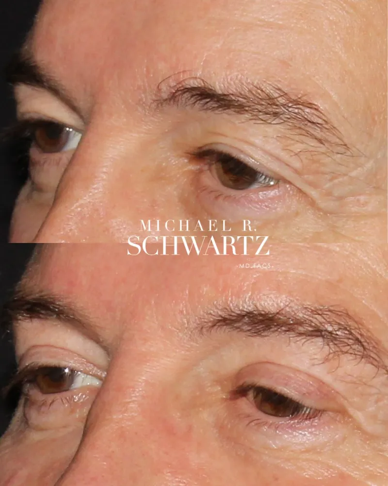 Before and after: Dr. Michael Schwartz