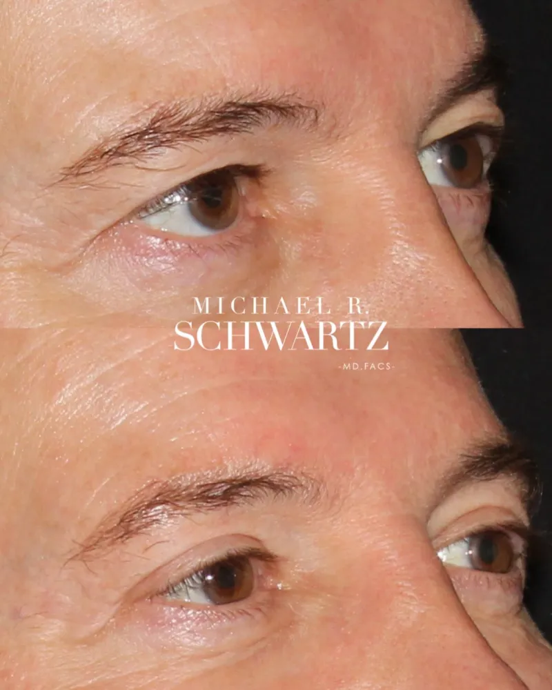 Before and after: Dr. Michael Schwartz