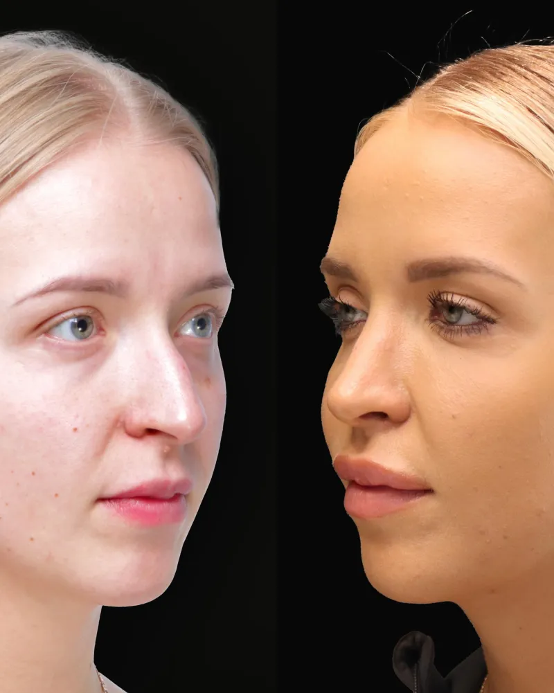 Before and after — Dr. Michał Charytonowicz