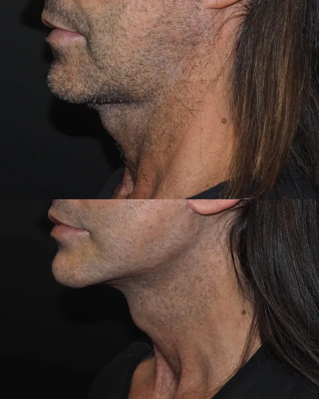 Before and after — Dr. Michele Pascali