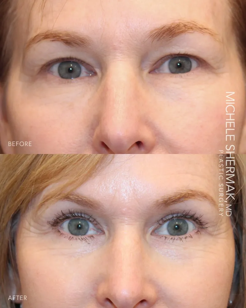 Before and after: Dr. Michele Shermak