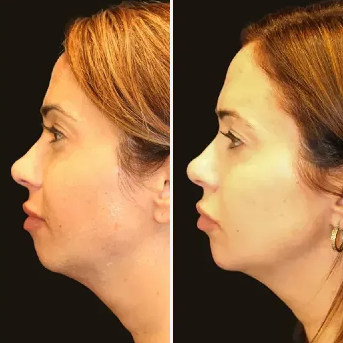 Before and after: Dr. Michele Shermak