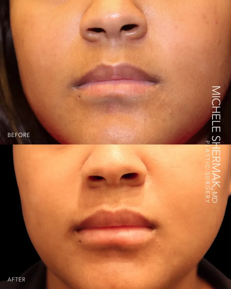 Before and after: Dr. Michele Shermak