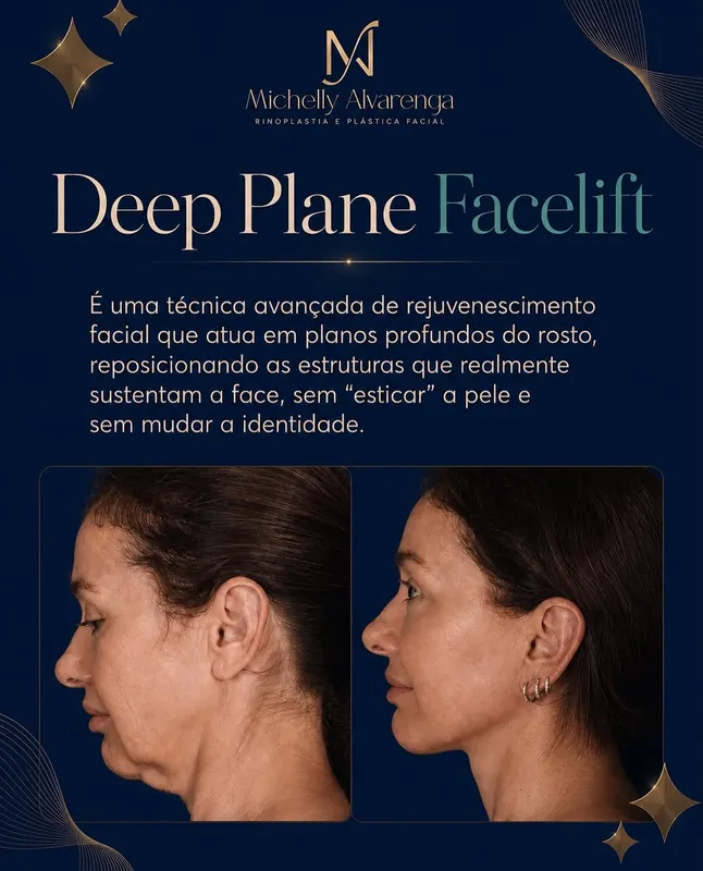 Before and after — Dr. Michelly Alvarenga