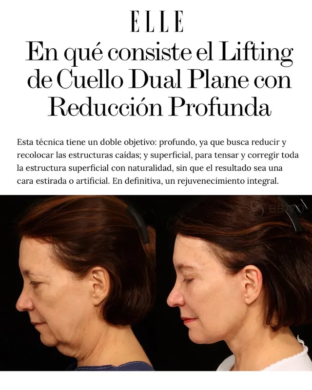 Before and after — Dr. Miguel Angel Gómez Bravo