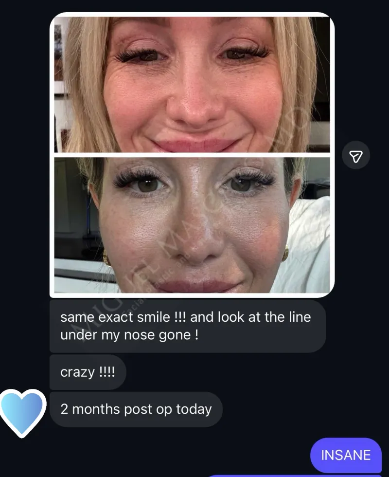 Before and after — Dr. Miguel Mascaro