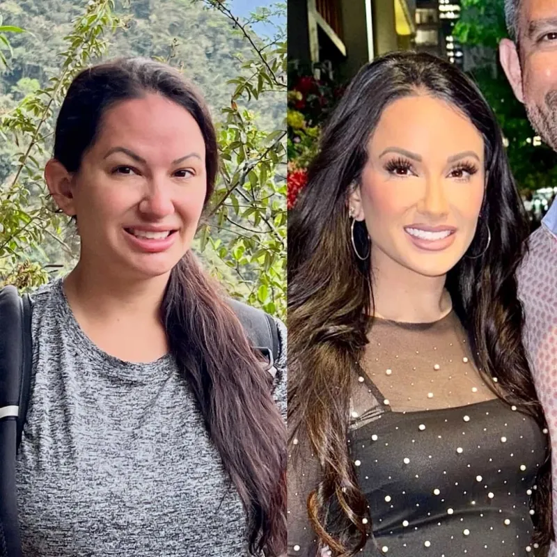 Before and after — Dr. Miguel Mascaro