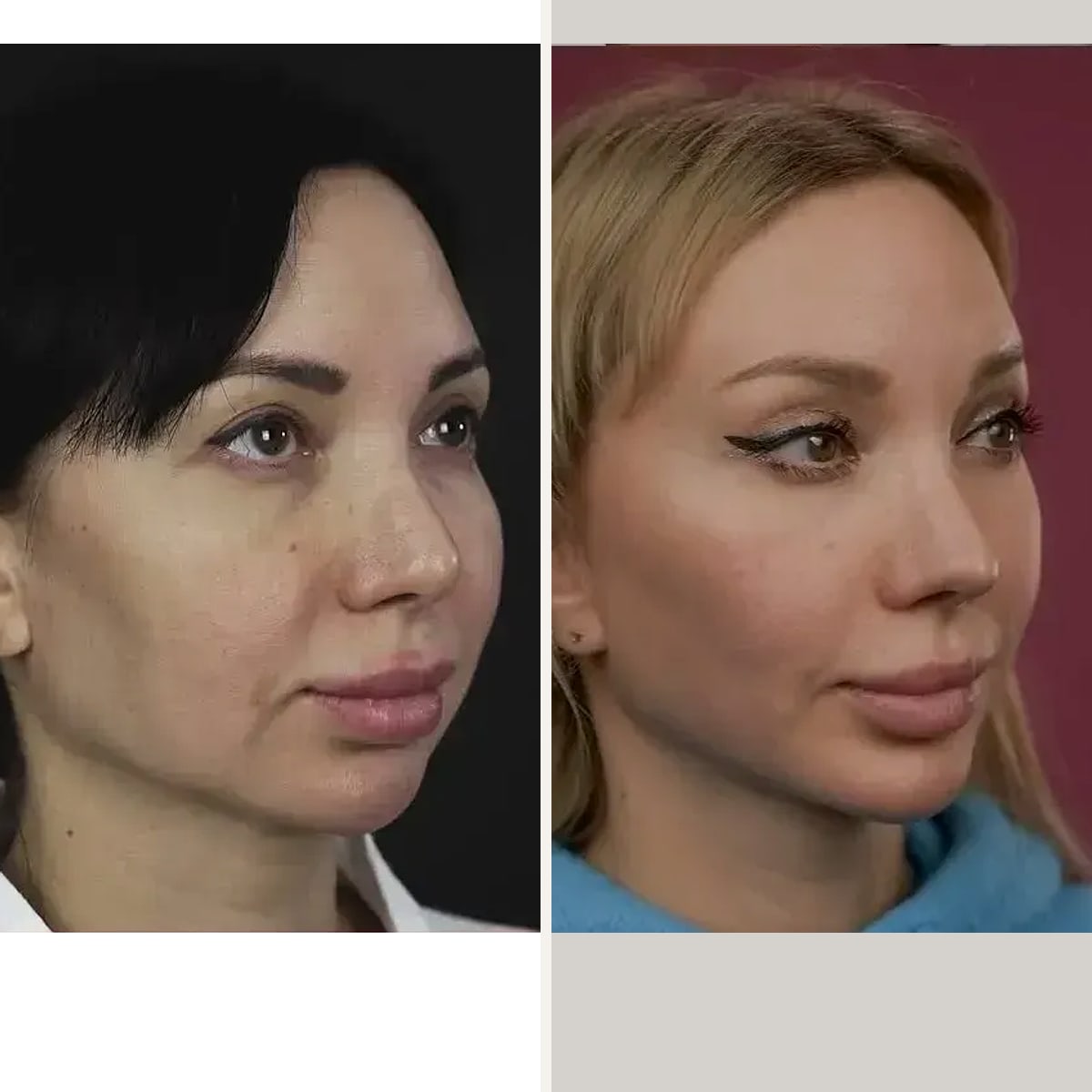Before and after: Dr. Mihail Frolov