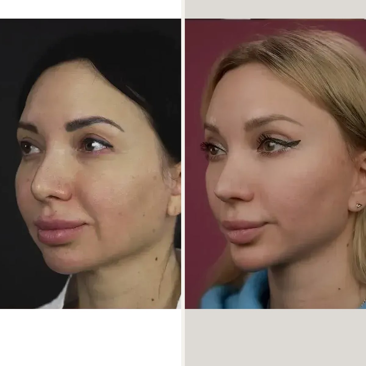 Before and after: Dr. Mihail Frolov