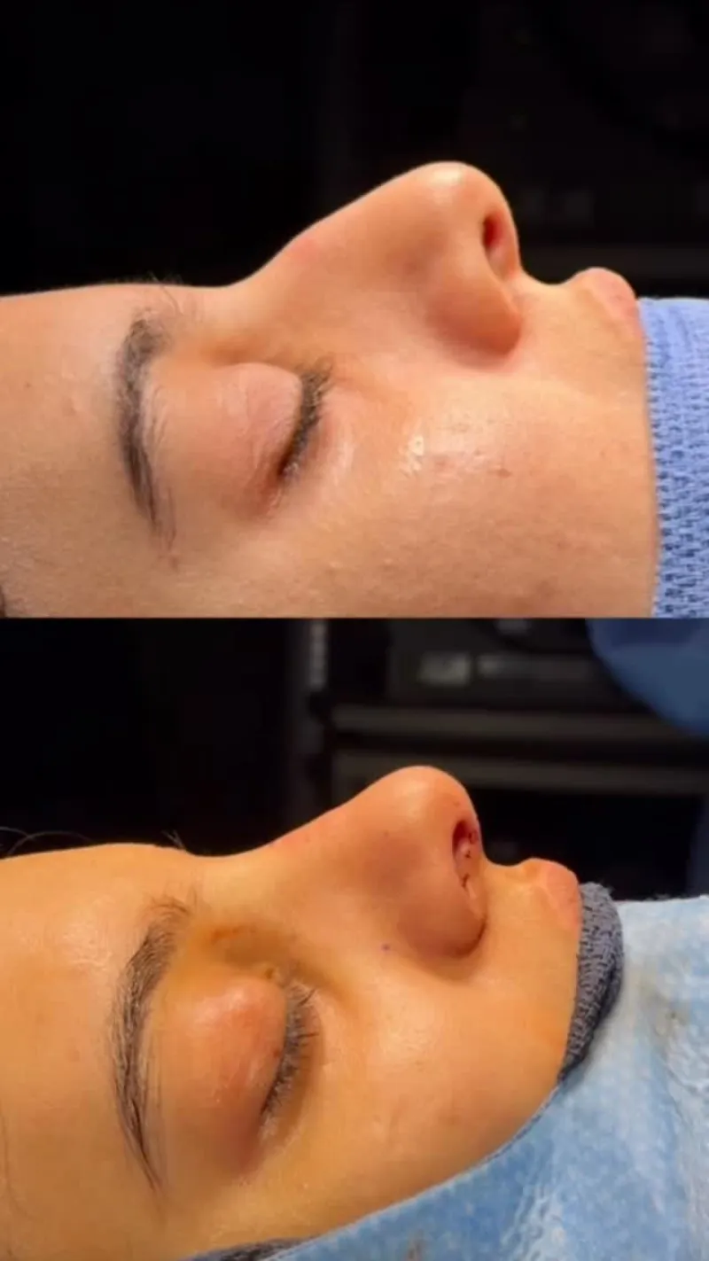 Before and after — Dr. Mike Eggerstedt
