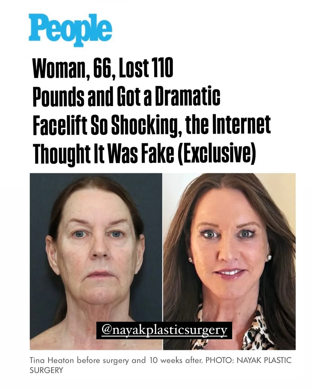 Before and after — Dr. Mike Nayak