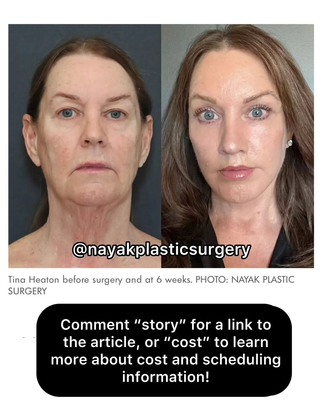 Before and after — Dr. Mike Nayak