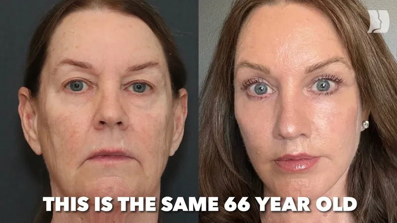 Before and after — Dr. Mike Nayak