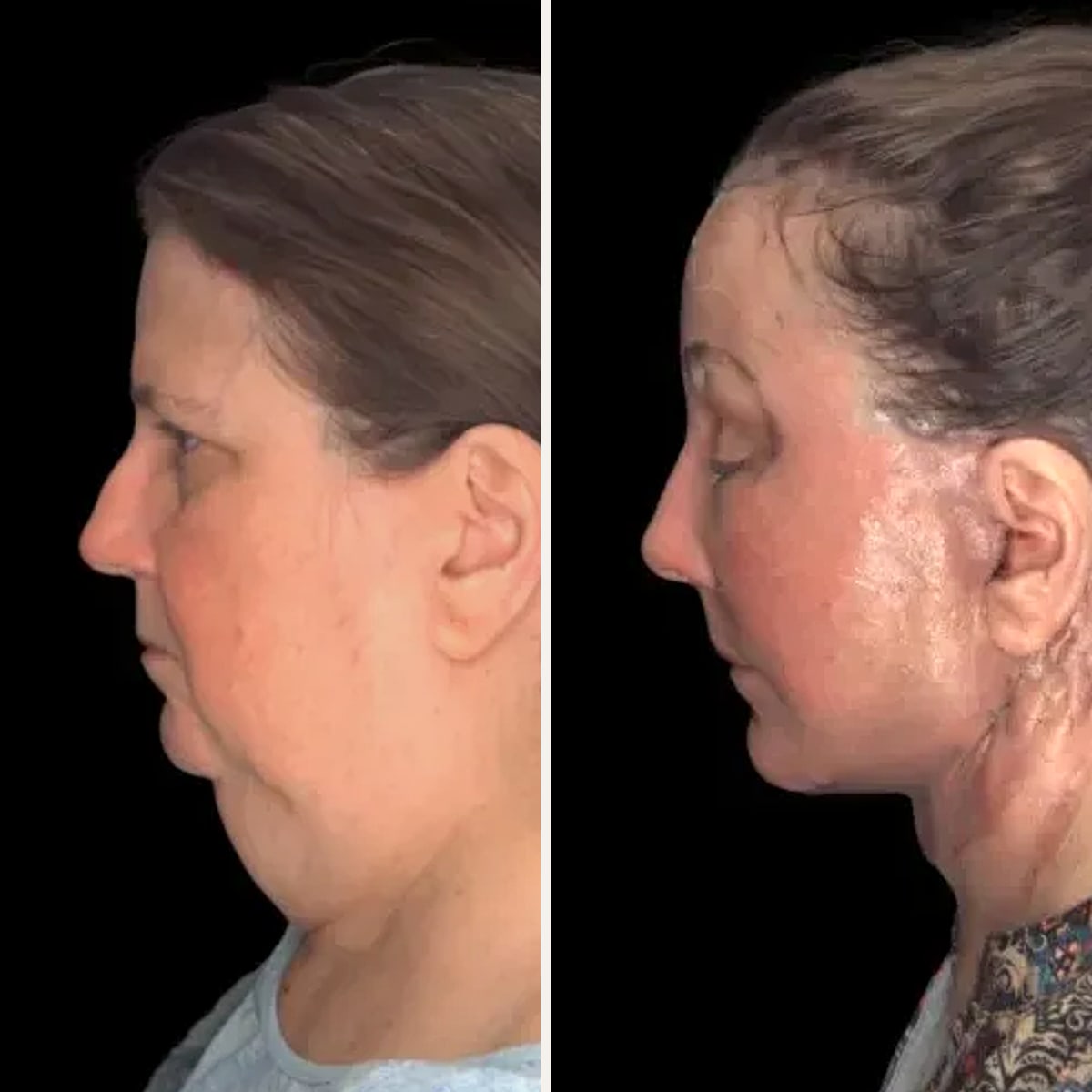 Before and after: Dr. Milind Kachare