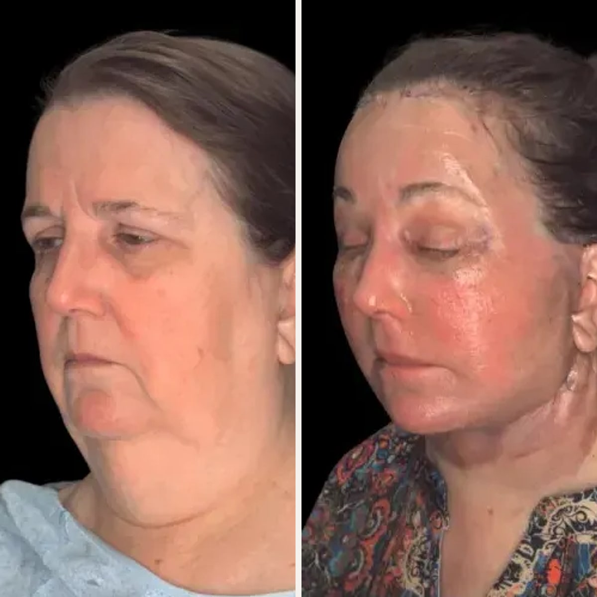 Before and after: Dr. Milind Kachare