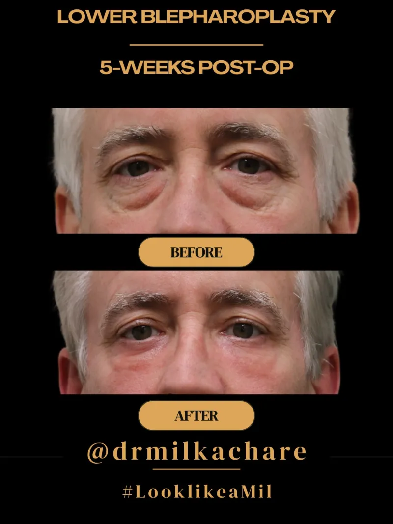 Before and after: Dr. Milind Kachare