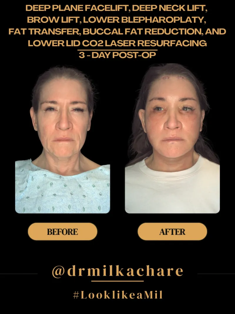 Before and after: Dr. Milind Kachare