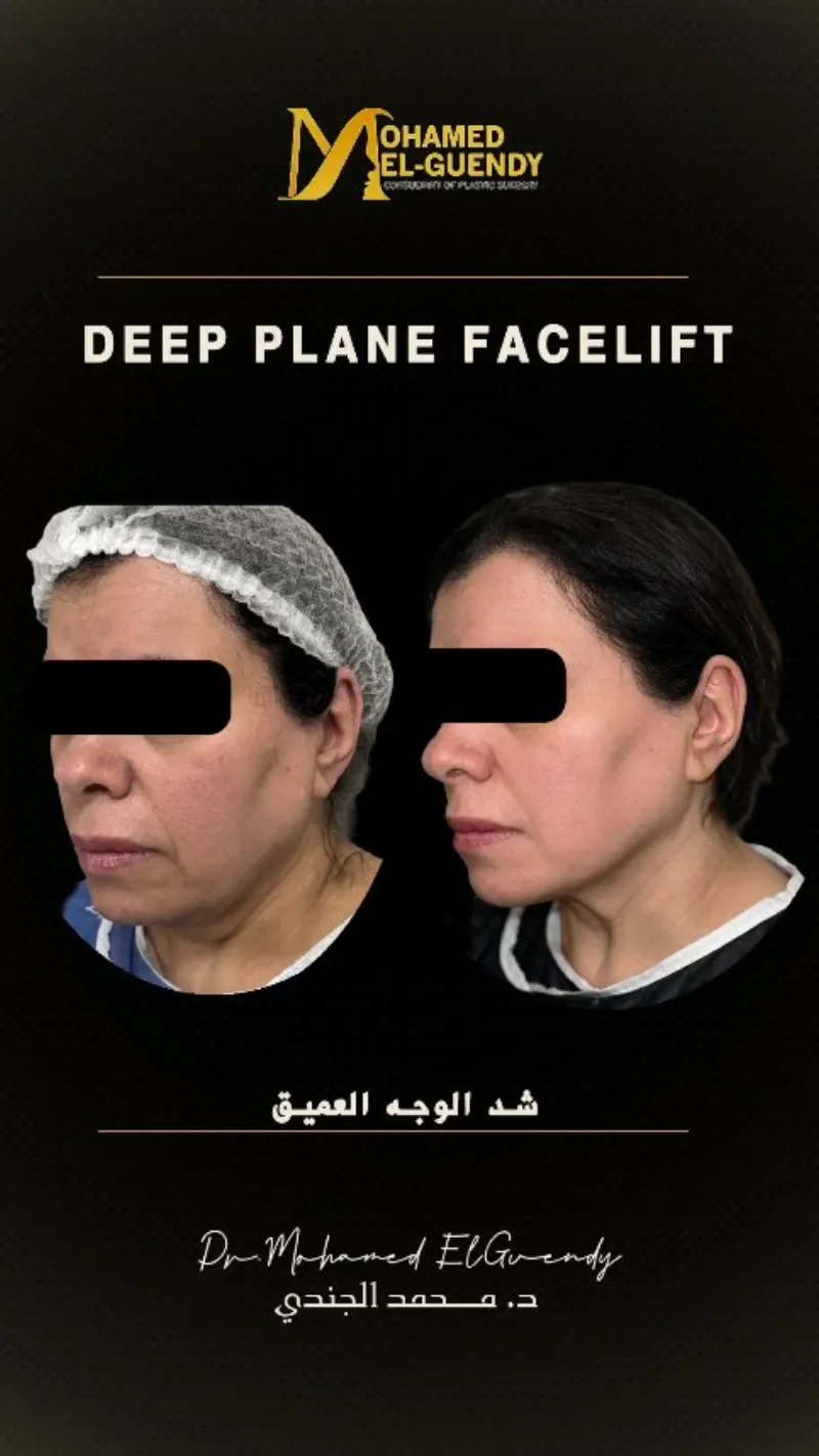Before and after: Dr. Mohamed El Guindy