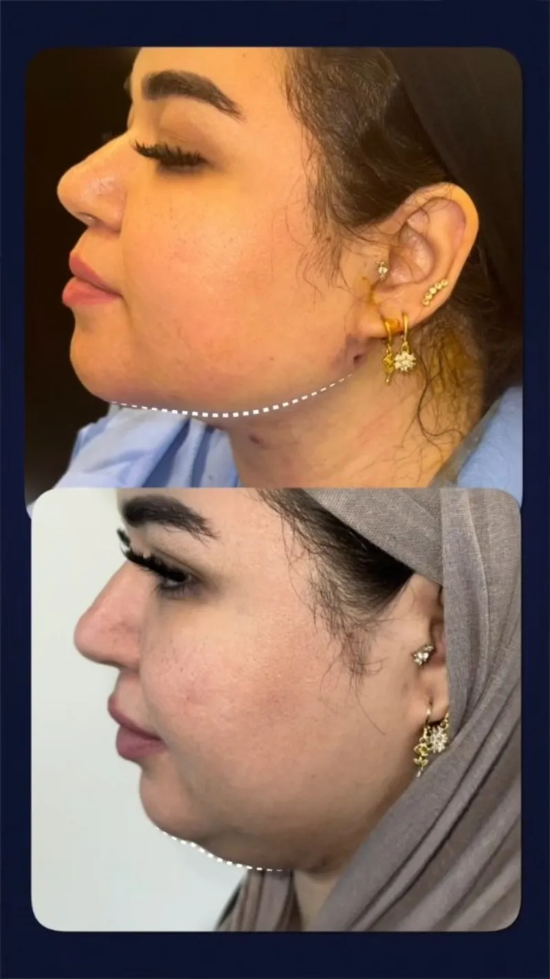 Before and after: Dr. Mohamed El Guindy