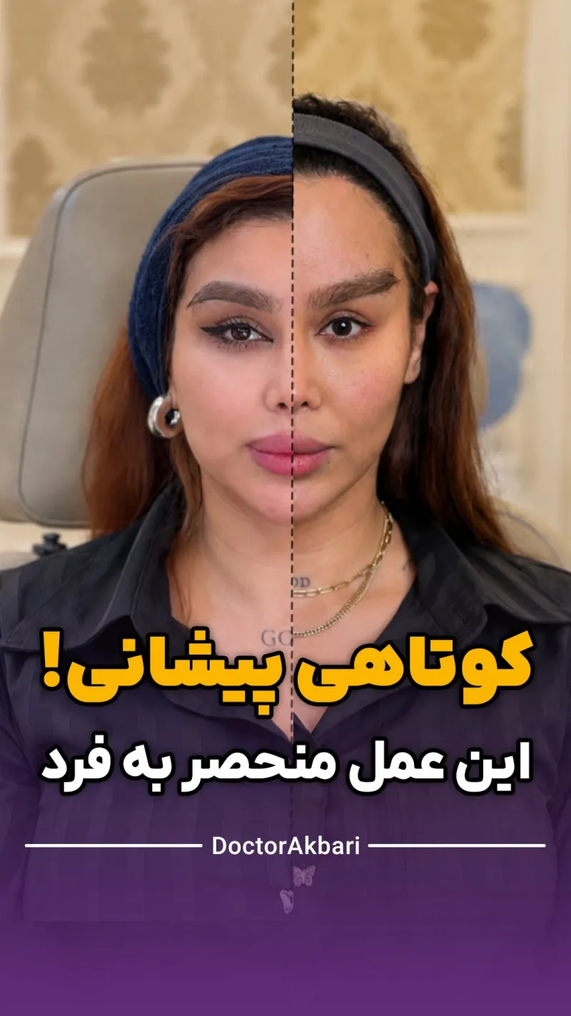 Before and after: Dr. Mohammad Ali Akbari