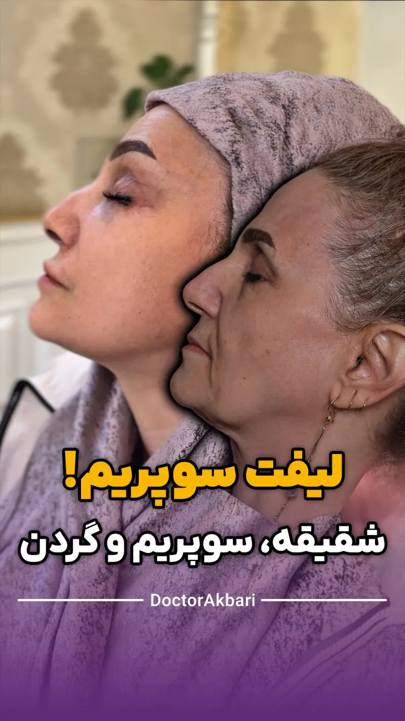 Before and after: Dr. Mohammad Ali Akbari