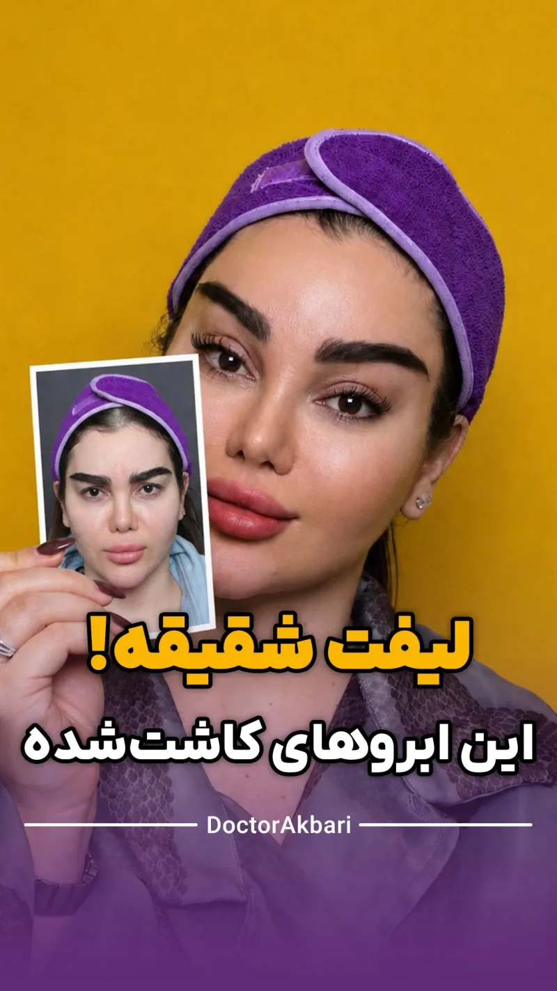 Before and after: Dr. Mohammad Ali Akbari