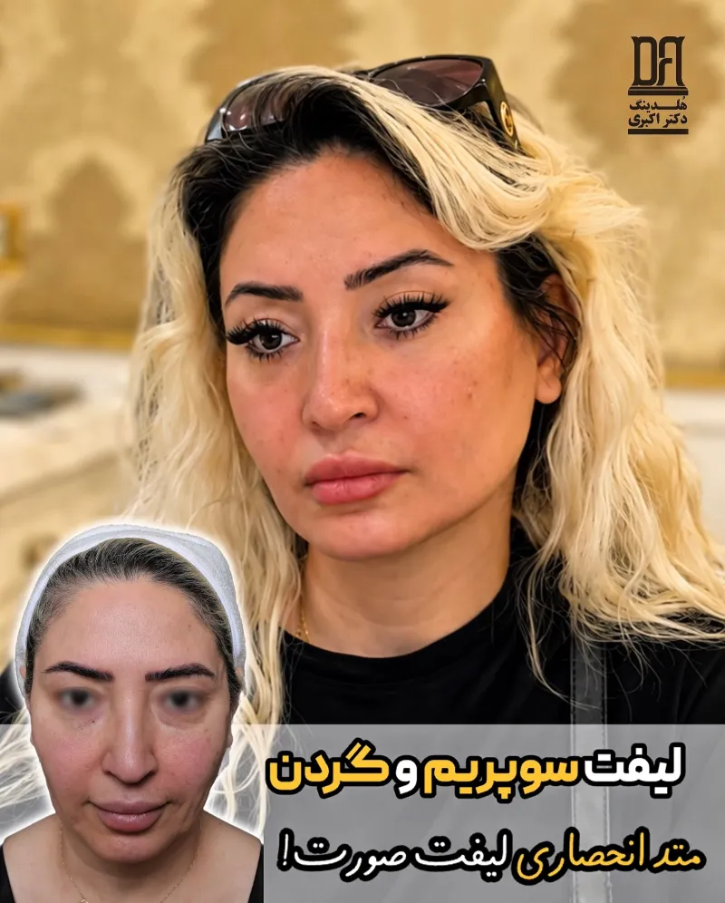 Before and after: Dr. Mohammad Ali Akbari