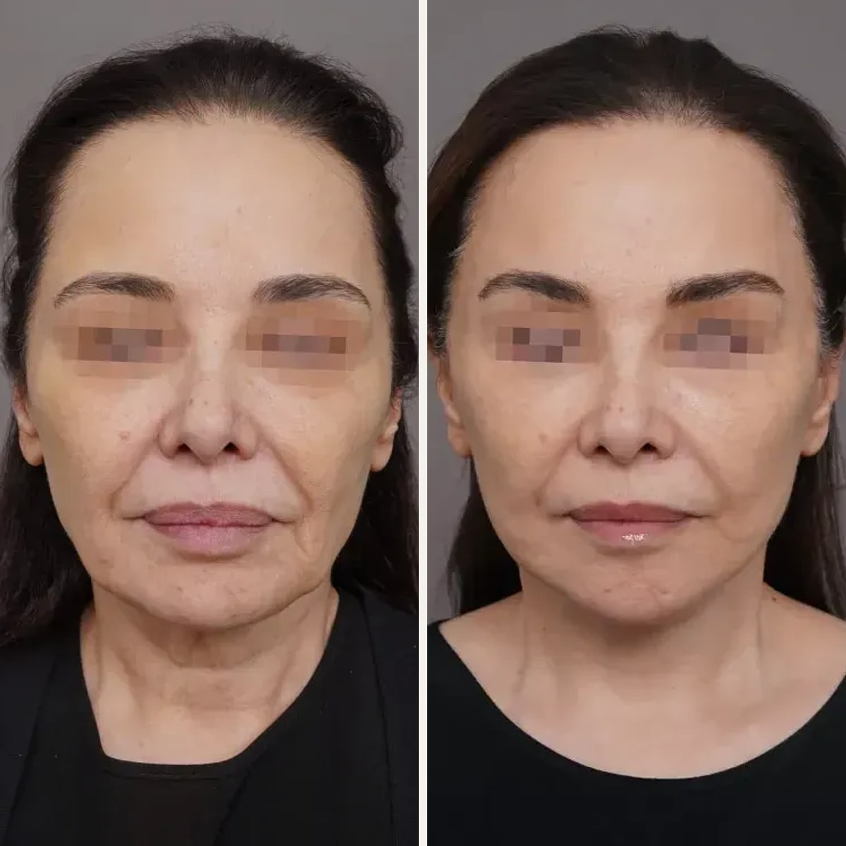 Before and after: Dr. Mohammed Alghoul