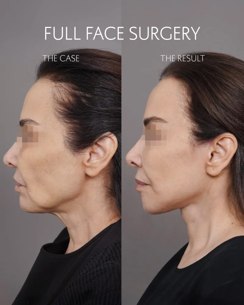 Before and after: Dr. Mohammed Alghoul