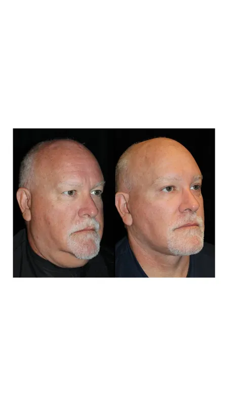 Before and after — Dr. Mune Gowda