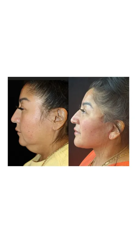 Before and after — Dr. Mune Gowda