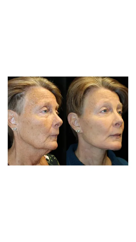 Before and after — Dr. Mune Gowda